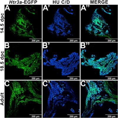 Serotonin Receptor 5-HT3A Affects Development of Bladder Innervation and Urinary Bladder Function